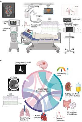 Editorial: Multimodal and auto-regulation monitoring in neuro-ICU